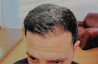 Your hair transplant and cost Virginia Surgical Center in Richmond in Virginia