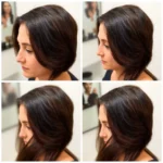 Hair Transplant Clinics in Bala Cynwyd, Pensilvania