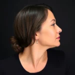 Hair Transplant Clinics in Brookfield, WI