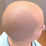 Hair Transplant Clinics in Columbus, OH