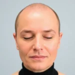 Hair Transplant Clinics in Farmington Hills, Michigan