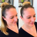 Hair Transplant Clinics in Mansfield, Texas