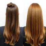 Hair Transplant Clinics in Midvale, Utah