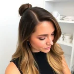 Hair Transplant Clinics in Milpitas, Santa Clara