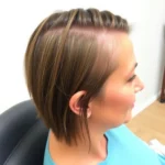 Best Hair Transplant Clinics In Albany, Nueva York