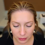 Best Hair Transplant Clinics In Annandale, Virginia