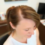 Best Hair Transplant Clinics In Chandler, Maricopa