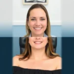 Best Hair Transplant Clinics In Cherry Hill Township, New Jersey