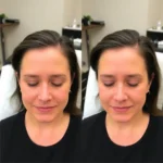 Best Hair Transplant Clinics In Huntersville, North Carolina