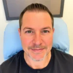 Best Hair Transplant Clinics In West Fargo, North Dakota